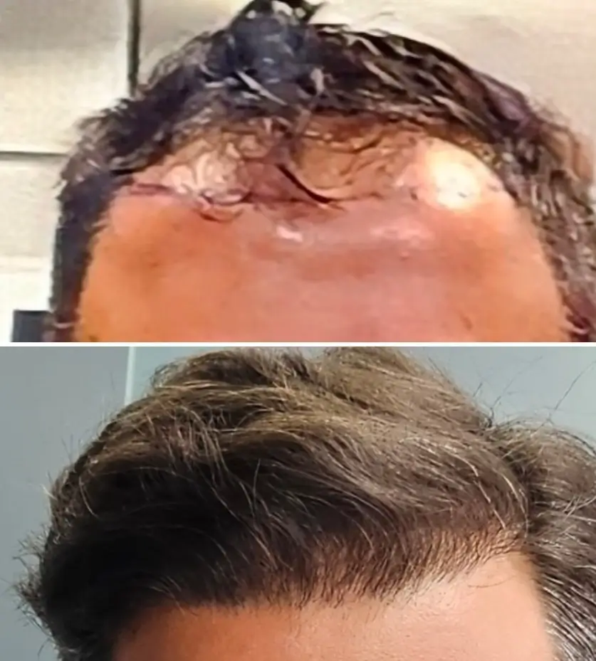 Before and After